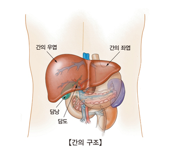 지방간