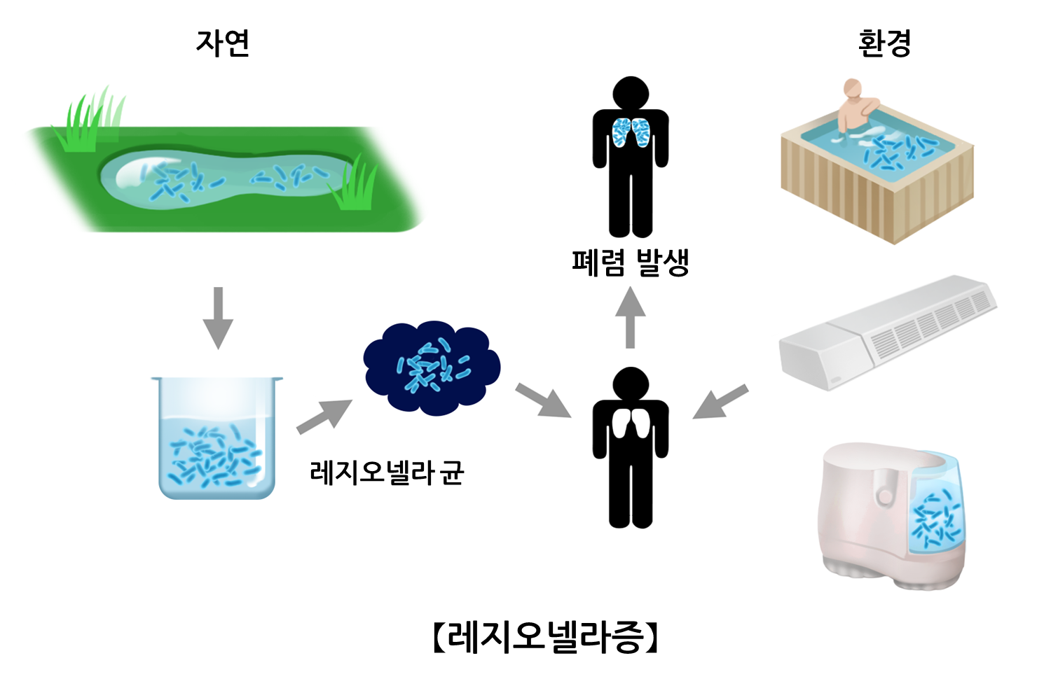 레지오넬라증