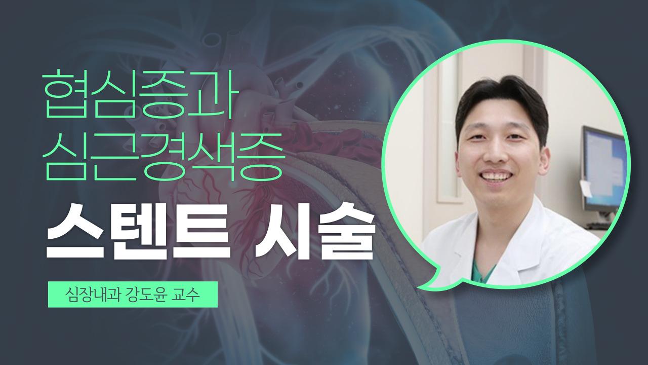 관상동맥 스텐트 시술