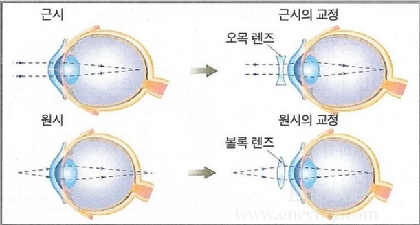 설명: http://blog.kimeye.co.kr/attach/1/8921737567.jpg?randseed=0.25734729727353034