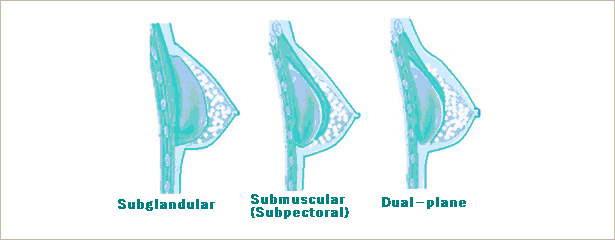 urgical techniques